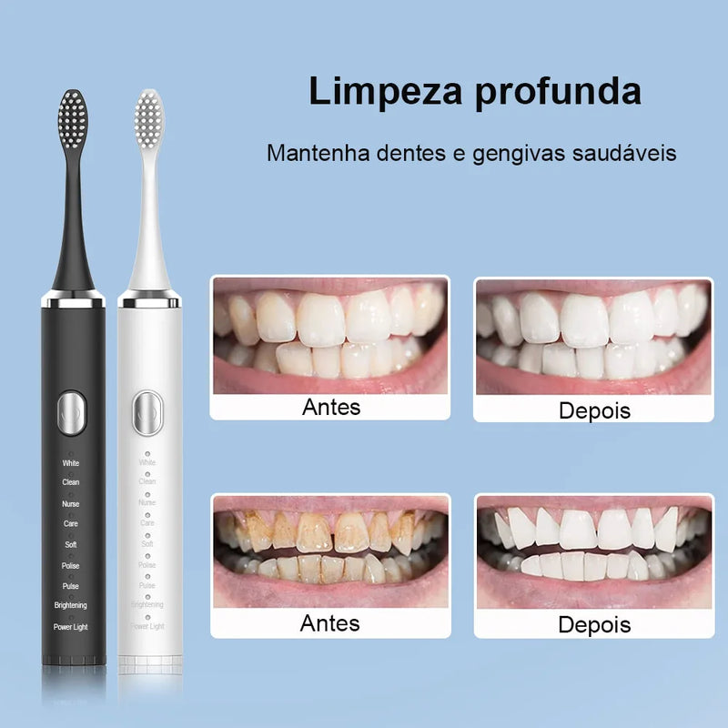 Escova de dentes elétrica - SoniBright Ultra